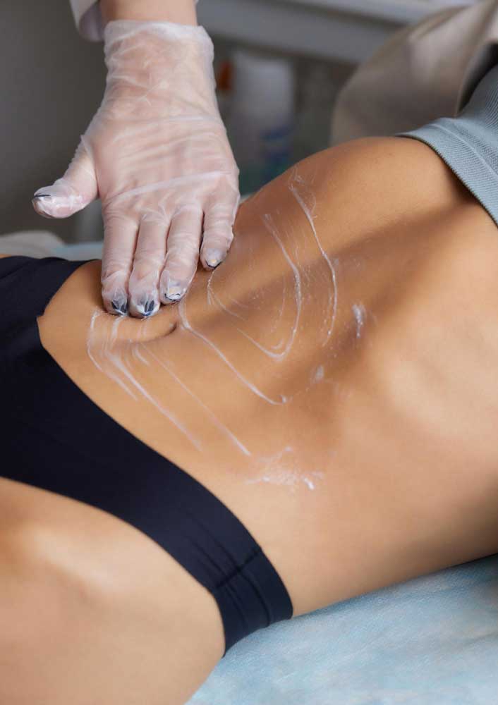 tratamiento-reductor-lpg-vitoria